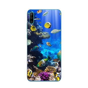 Štýlový kryt pre Xiaomi Redmi 13